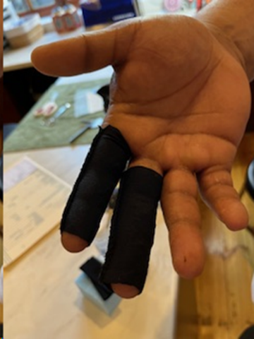 The image displays two fingers of an injured hand strapped in taping, for a speedy recovery.